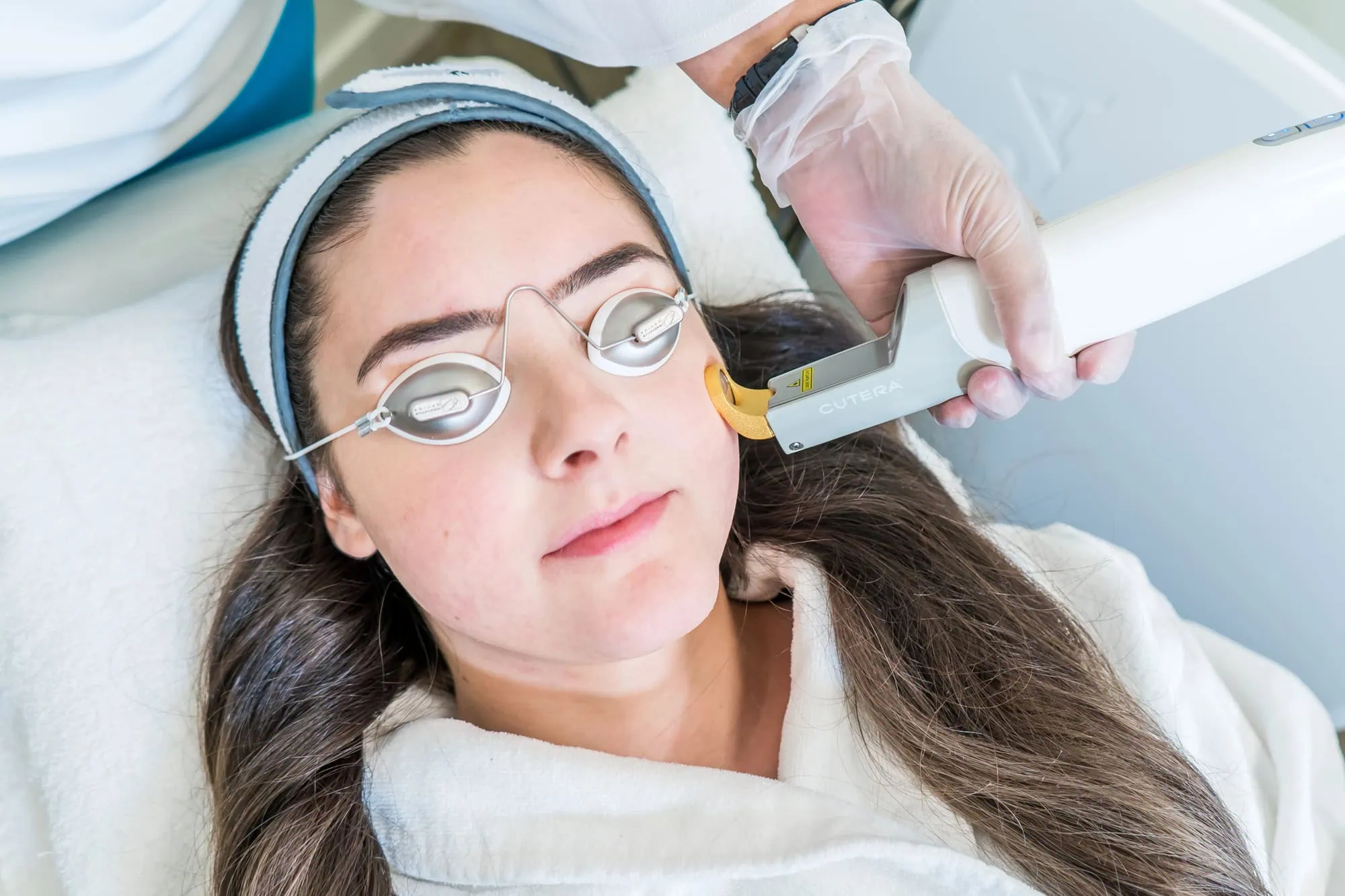 best laser for rosacea