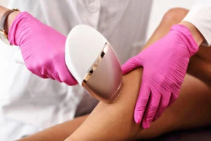 Person in pink gloves using a handheld device on a bare leg, possibly performing a laser hair removal or skin treatment procedure in a clinical or spa setting.