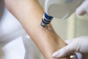laser therapy downtime