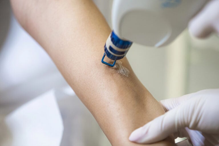 laser therapy downtime
